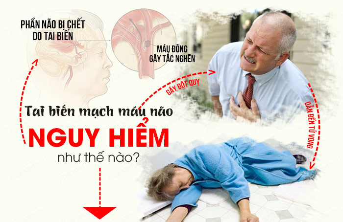 tai-bien