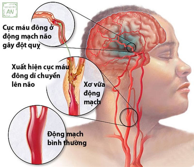 nguoi-tai-bien-co-chua-duong-khong