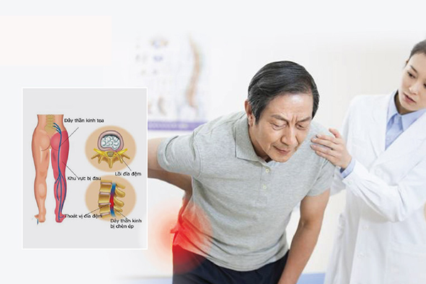 Điều trị đau mỏi lưng eo – cột sống bằng phương pháp dưỡng sinh đông y