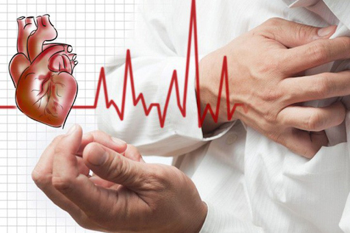 Hạn chế Đột quỵ bằng phương pháp dưỡng sinh đông y