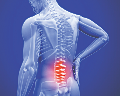 Nguyên nhân bệnh đau thắt lưng ở phụ nữ trung niên