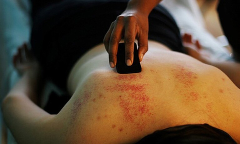 Lời khuyên từ thầy thuốc