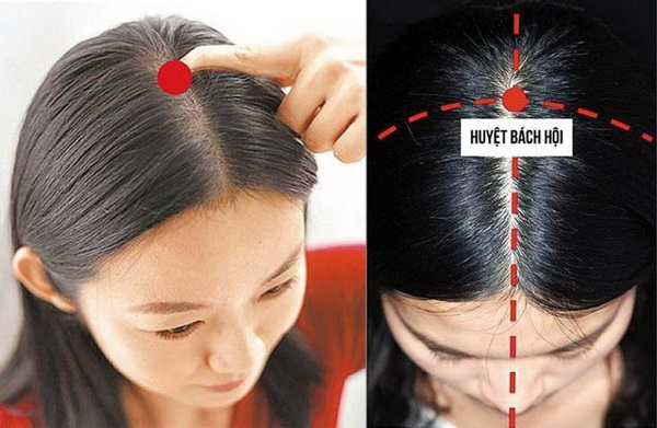 Bấm huyệt bách hội giúp trị đau đầu hiệu quả