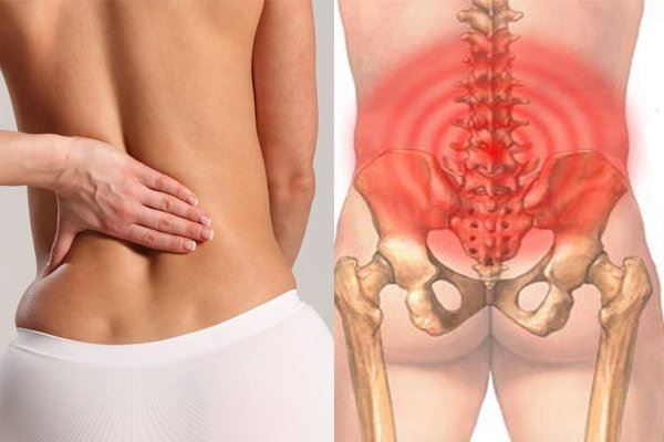 Đau mỏi lưng eo là bệnh lý phổ biến