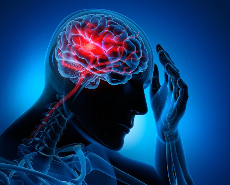 Đột quỵ còn gọi là tai biến mạch máu não