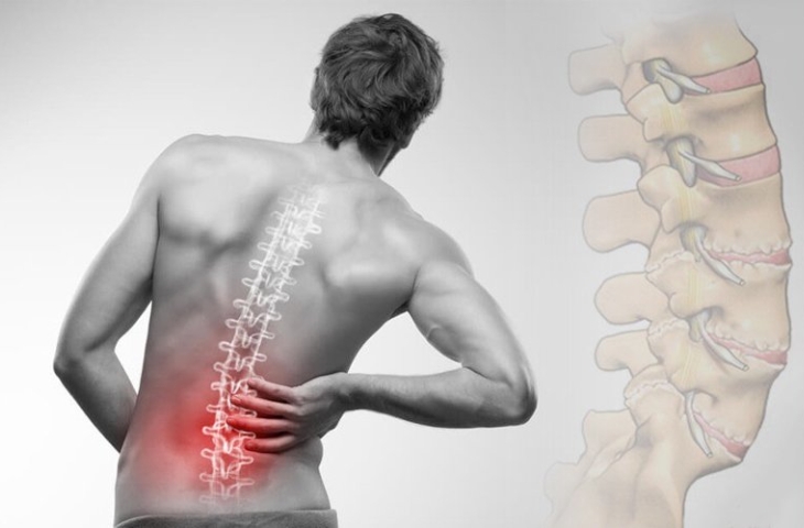 Đau thắt lưng là chứng bệnh phổ biến ở nam giới hiện nay