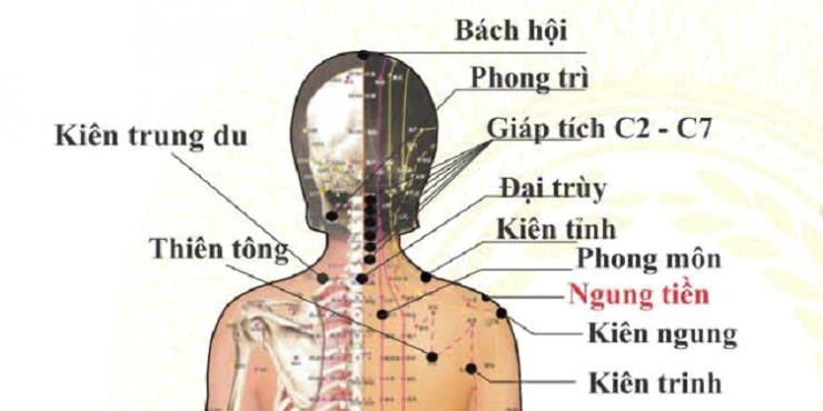 Kiến thức cơ bản về hệ thống huyệt đạo ở vùng cổ, vai, gáy là một phần của khóa học
