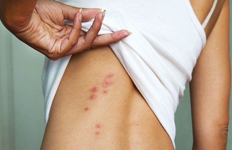 Chế độ sinh hoạt và dinh dưỡng không hợp lý cũng gây ra nóng gan
