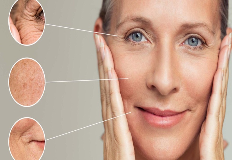 Lão hóa da mặt là một quá trình tự nhiên của cơ thể khi tuổi tác tăng lên